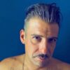 Francesco Gabbani operato alle corde vocali